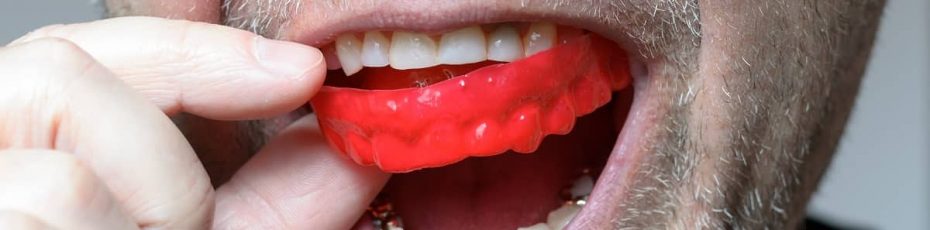 how does a mouth guard protect your teeth