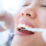 how long do dental sealants last care tips