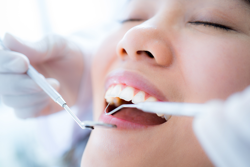 how long do dental sealants last care tips